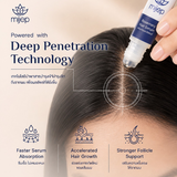 Rosemary Hair Growth Serum Roll-on